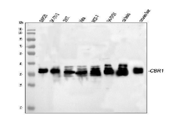 Anti-CBR1 Picoband® Antibody