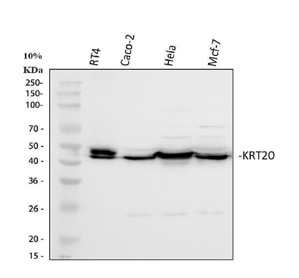 Anti-Cytokeratin 20/Krt20 Antibody Picoband®