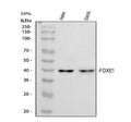 Anti-FOXE1 Picoband® Antibody