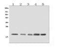 Anti-BAFF Receptor/TNFRSF13C Antibody Picoband®
