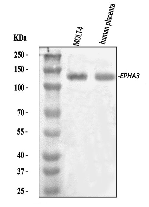 Anti-Eph receptor A3/EPHA3 Antibody Picoband®