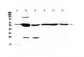 Anti-Glycerol kinase/GK Antibody Picoband®