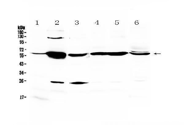 Anti-Glycerol kinase/GK Antibody Picoband®