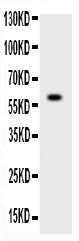 Anti-ADAMTS4/ADAMTS4 Antibody Picoband®