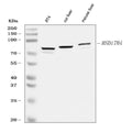 Anti-Hydroxysteroid (17-beta) Dehydrogenase 4/HSD17B4 Antibody Picoband®