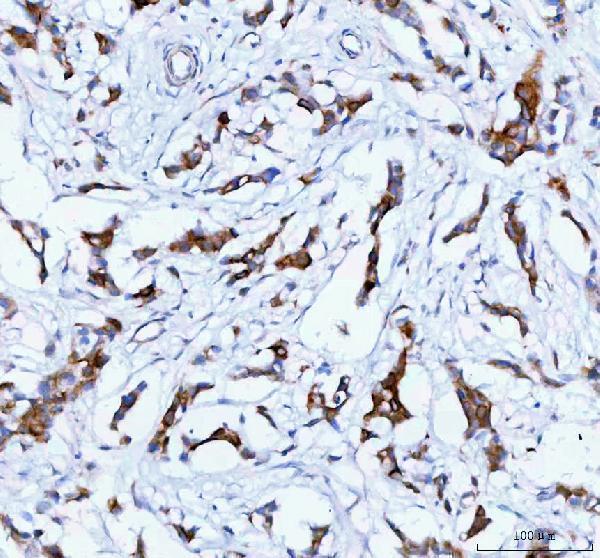 Anti-TACI/TNFRSF13B Antibody