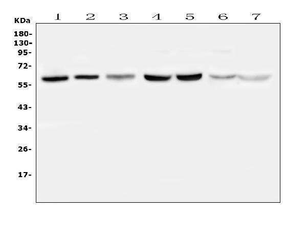 Anti-TPA Tissue Plasminogen Activator/PLAT Antibody Picoband®