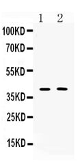 Anti-Islet 1/ISL1 Antibody Picoband®