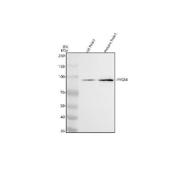 Anti-PYGM Antibody Picoband®