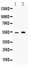 Anti-CDR2 Antibody Picoband®