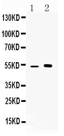 Anti-CDR2 Antibody Picoband®