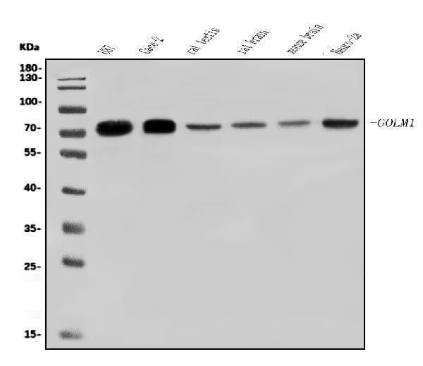 Anti-GOLPH2/GOLM1 Antibody Picoband®