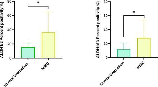IHC analysis to check the expression of ALDH1/2 and ALDH1A3 in MIBC tumors and distant normal urothelium. Asterisks in the graphs denote statistical significance as “*” p < 0.05. 
Index in PubMed under a CC BY license. PMID: 40595790