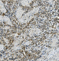 Anti-MRP5/ABCC5 Antibody