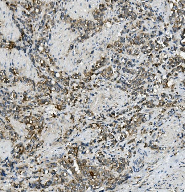 Anti-MRP5/ABCC5 Antibody