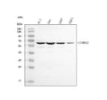 Anti-CAMKK2 Antibody Picoband®