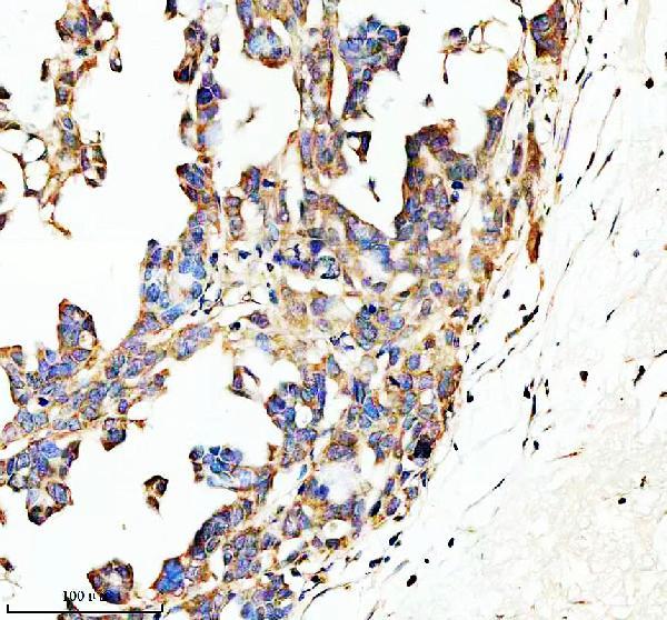 Anti-SPON1 Antibody