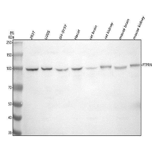 Anti-IA-2/PTPRN Antibody Picoband®