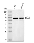 Anti-GAD65/GAD2 Antibody Picoband®