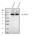 Anti-col6a2 Antibody Picoband®