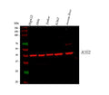 Anti-ACAT2 Antibody Picoband®