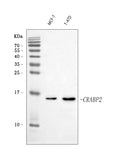 Anti-CRABP2 Antibody Picoband®