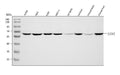 Anti-Asparagine synthetase/ASNS Antibody Picoband®