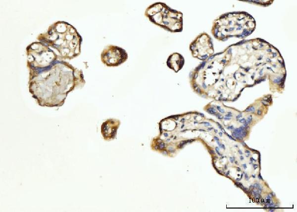 Anti-FGF3 Antibody