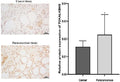 Comparison of human samples through immunohistochemical detection of ALKBH5 expression. ( * P < 0.05 indicates a significant difference between the indicated groups). 
Index in PubMed under a CC BY license. PMID: 39789120