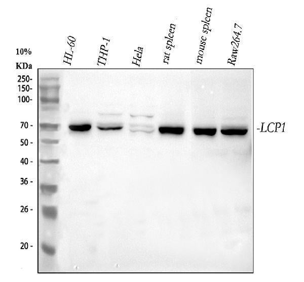 Anti-Plastin L/LCP1 Antibody Picoband®