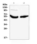 Anti-Vitamin D Binding protein/GC Antibody Picoband®