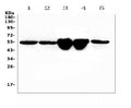 Anti-Vitamin D Binding protein/Gc Antibody Picoband®
