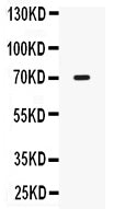 Anti-IL12RB1 Antibody Picoband®