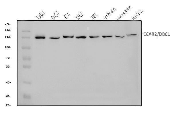 Anti-DBC-1/CCAR2 Antibody Picoband®