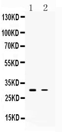 Anti-TSG6/TNFAIP6 Antibody Picoband®