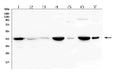 Anti-Creatine Kinase MM/CKM Antibody Picoband®