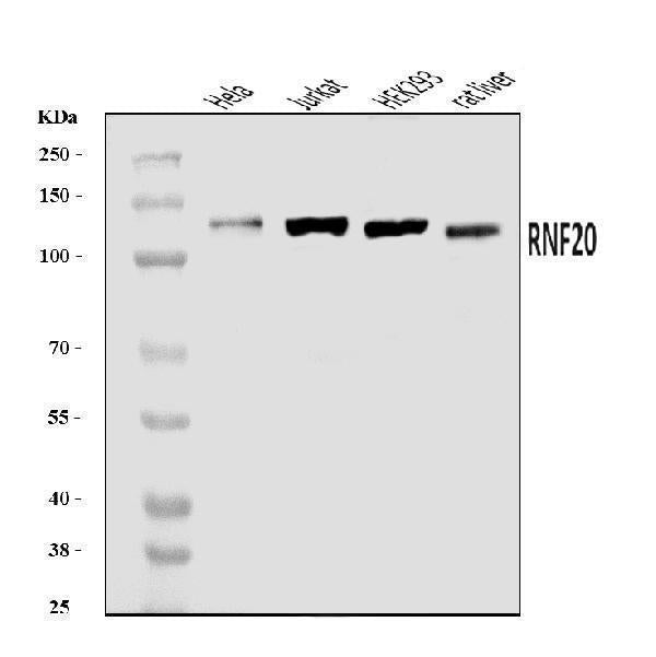 Anti-RNF20 Antibody Picoband®