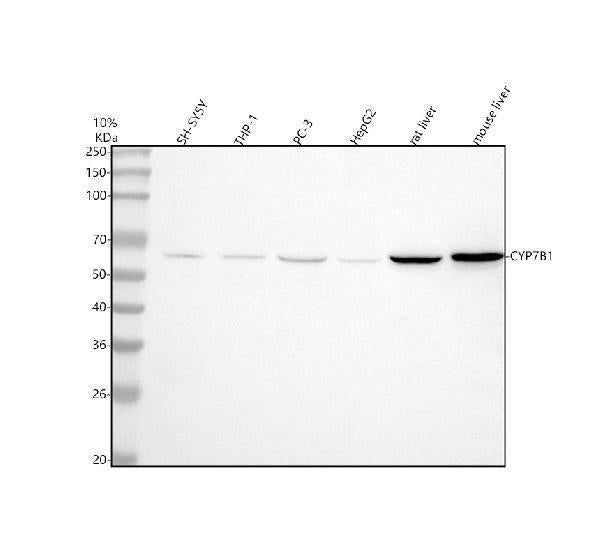 Anti-CYP7B1 Antibody Picoband®
