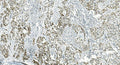 Anti-IL37 Antibody