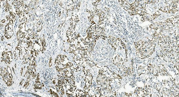 Anti-IL37 Antibody