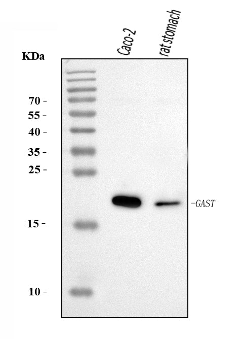 Anti-Gastrin/GAST Antibody Picoband®