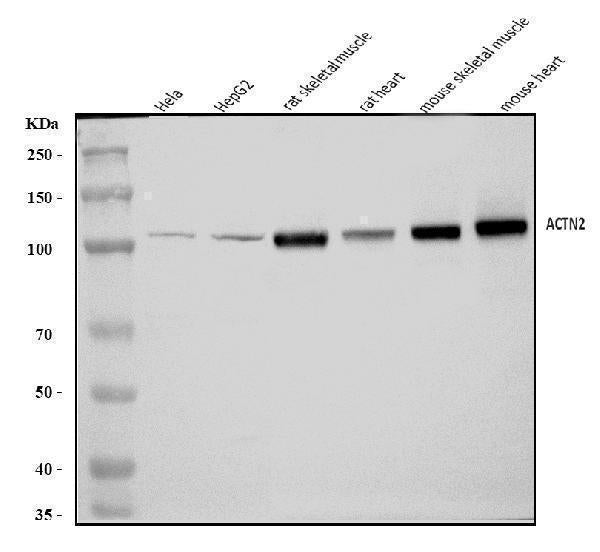 Anti-ACTN2 Antibody Picoband®