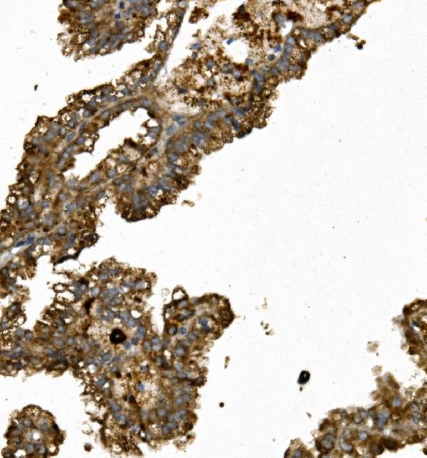 Anti-REN/Renin Antibody