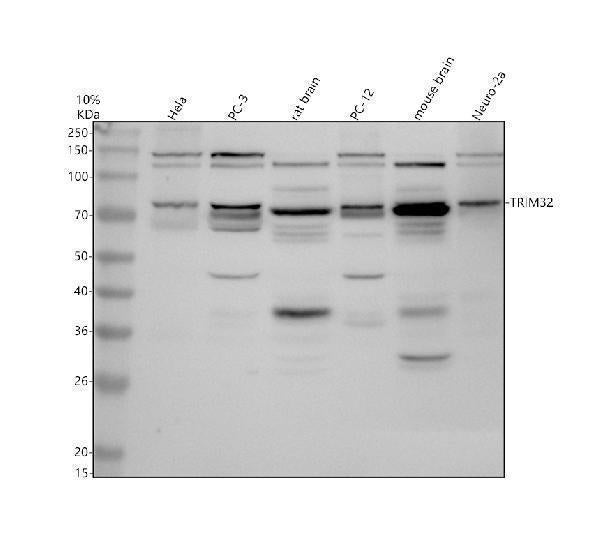 Anti-TRIM32 Antibody Picoband®
