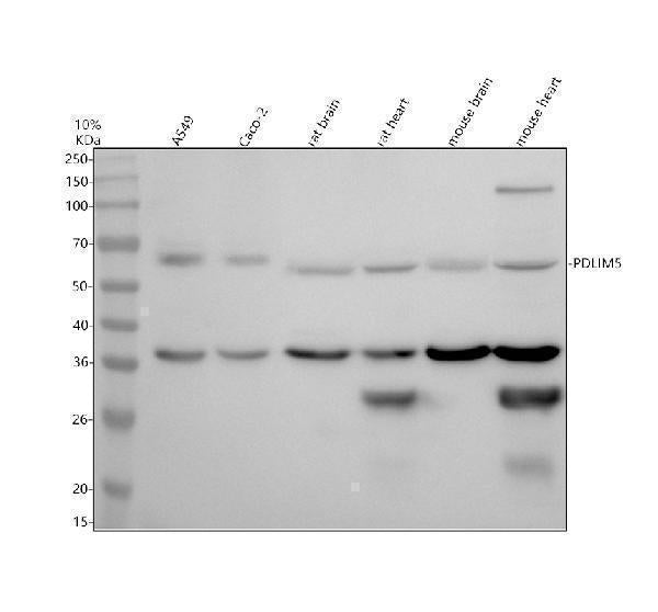 Anti-PDLIM5 Antibody Picoband®