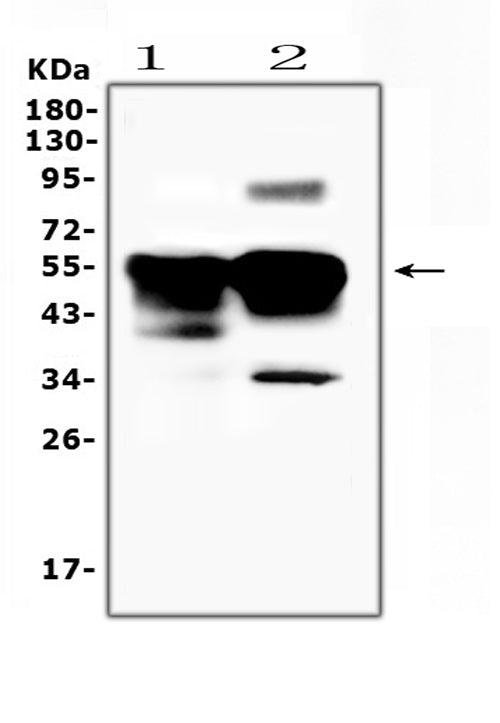 Anti-Retinal S antigen/SAG Antibody Picoband®