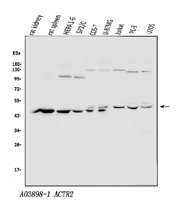 Anti-Arp2/ACTR2 Antibody Picoband®