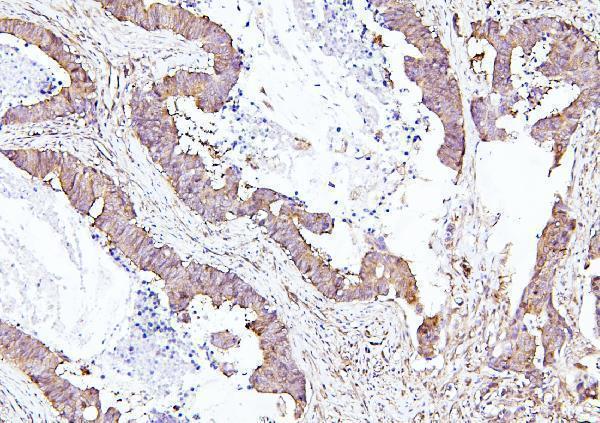 Anti-EIF4A1/2/3 Antibody Picoband®