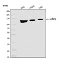 Anti-AlaRS/AARS1 Antibody Picoband®