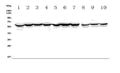 Anti-ACCN1/ASIC2 Antibody Picoband®